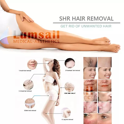Beauty Salon Ipl Ice Cooling Skin Rejuvenation Hair Removal Laser Machine. آلة إزالة الشعر بالليزر