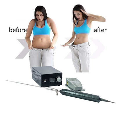 جراحة التجميل شفط الدهون جهاز الاهتزاز الكهربائي 300W