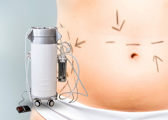 آلة شفط الدهون بالجسم التخسيس للجسم لمدة 12 شهرًا