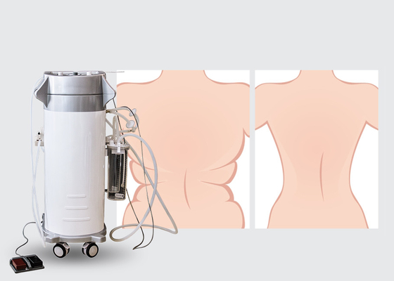 آلة شفط الدهون الجراحية 300W لشفط الدهون في الظهر العلوي / السفلي