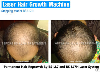 جهاز إعادة نمو الشعر بالليزر عالي الكثافة مع مستوى طاقة مُعدل 650nm / 670nm