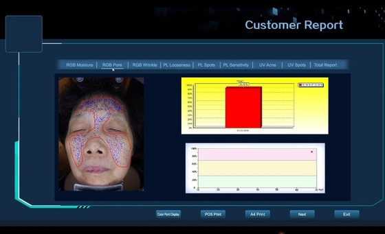 3D الوجه اختبار الجلد آلة الجلد المسام ، التجاعيد ، البقع ، جهاز تحليل حب الشباب