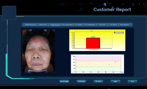 3D الوجه اختبار الجلد آلة الجلد المسام ، التجاعيد ، البقع ، جهاز تحليل حب الشباب