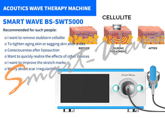 6 الارسال آلة العلاج الموجة الصوتية لإزالة علامات التمدد / إعادة تشكيل الجسم