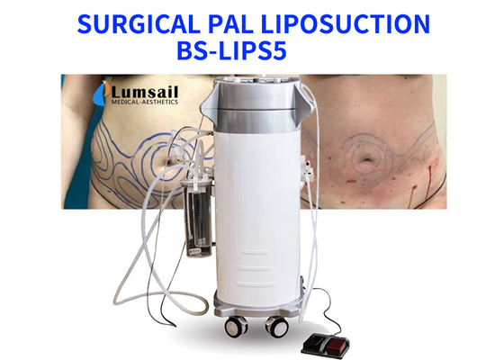 BS-LIPS5 300W قوة شفط الدهون معدات للثدي الرقبة والذقن