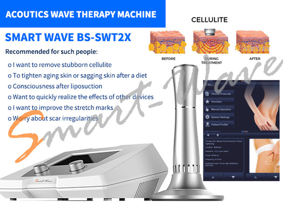 صالون تجميل BS-SWT2X جهاز معالجة الموجات الصوتية مع إزالة السيلوليت ضمان لمدة سنة